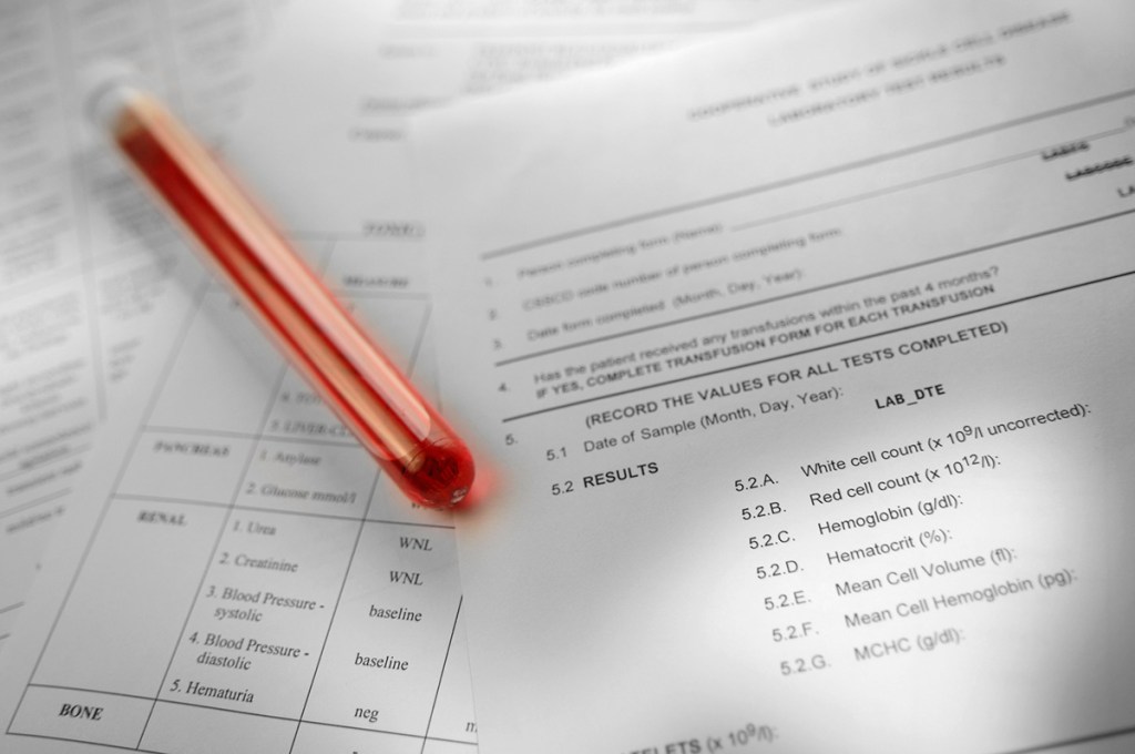 Photo of a vial of blood on top of printed lab results