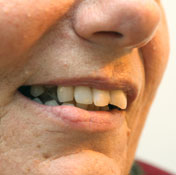 Injury Upon Injury: Californians Losing Jobs Find State Health Safety Net Is Badly Frayed